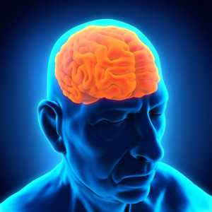 concussions